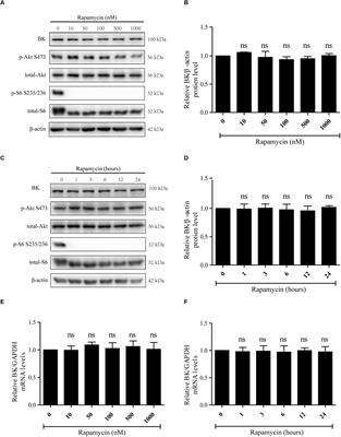 Mechanism of Regulation of Big-Conductance Ca2+-Activated K+ Channels by mTOR Complex 2 in Podocytes